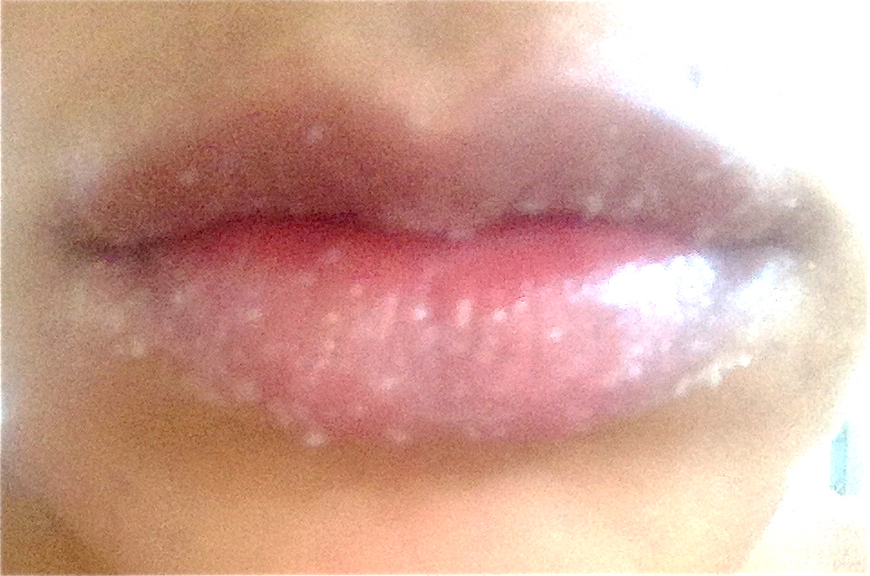Berry Lips